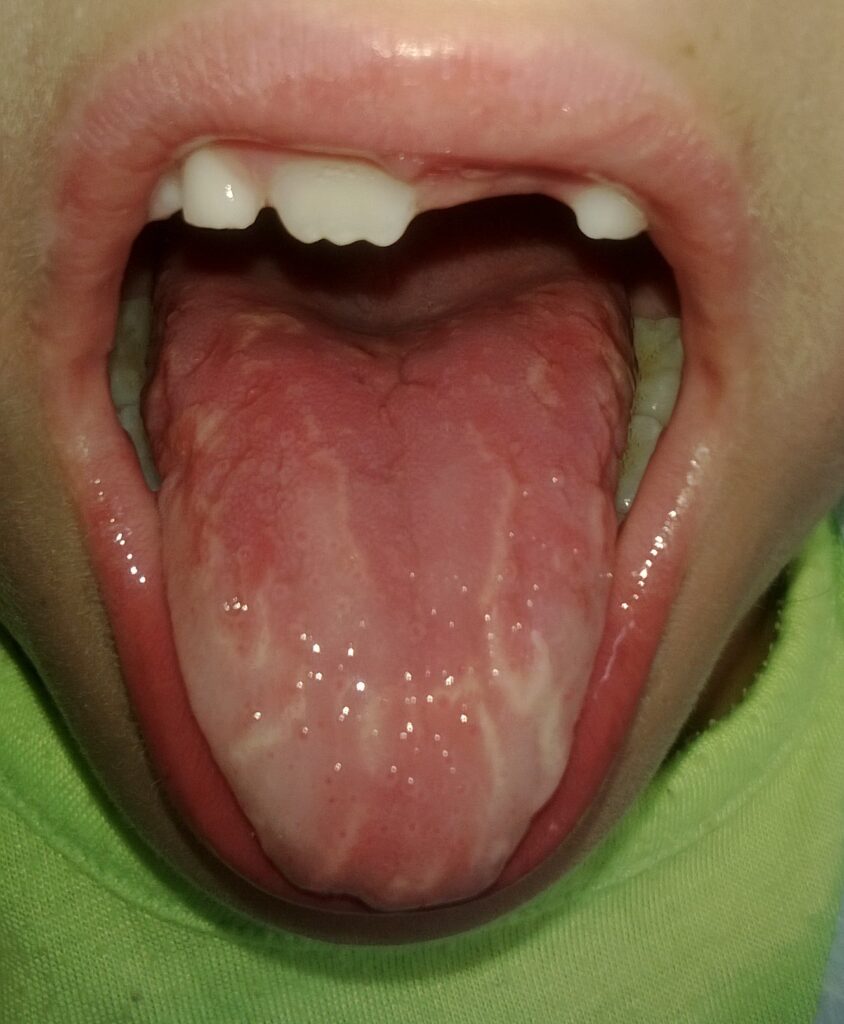 Lengua geográfica